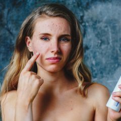 אלרגיה לקוסמטיקה ואיפור