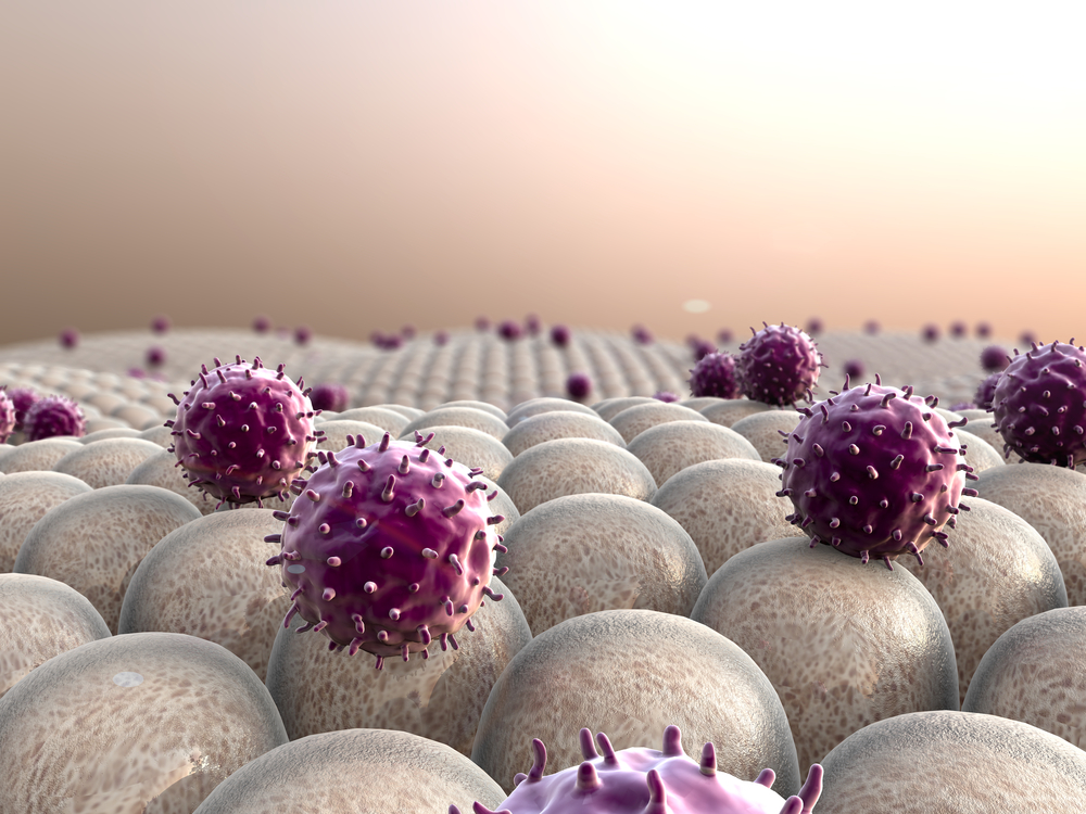 חסר בנוגדנים – סיבה שכיחה לחסר חיסוני