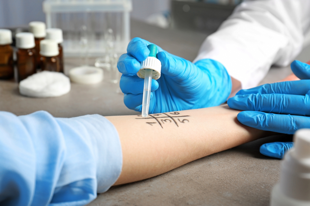 אימונותרפיה תת לשונית – חיסון מותאם אישית